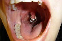 Piercing sur glotte