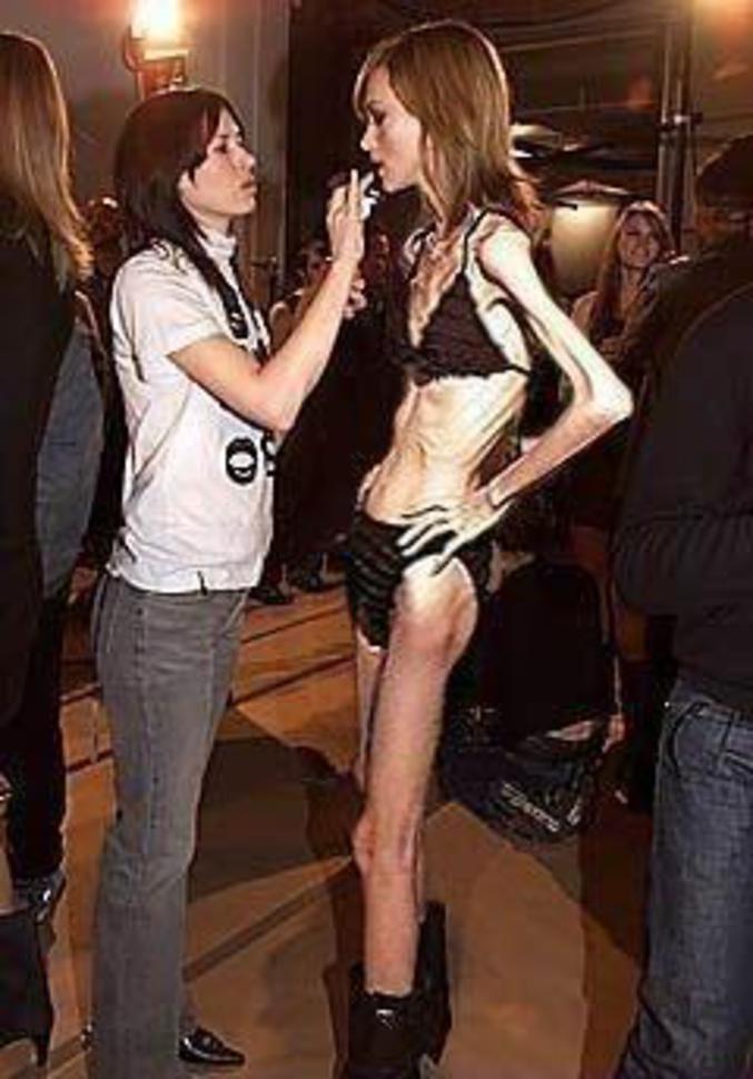 Une mannequin anorexique qui joue gravement avec sa santé.