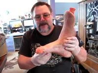 Pied amputé