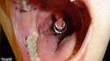 Piercing idiot