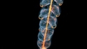 Un siphonophore (Marrus orthocanna)