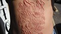 Scarification