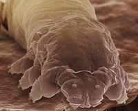 Demodex folliculorum