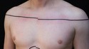 Tatouage particulier