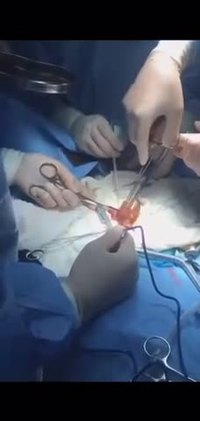 Lendemain de soirée difficile