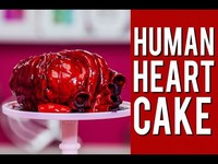 Coeur artificiel
