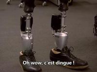 Prothèse de cheville