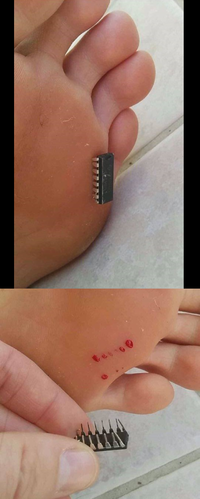 Marcher sur un Lego c'est de la gnognotte.