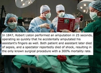 Robert Liston, ce chirurgien de l'extrême