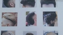 Coupes de cheveux non autorisées