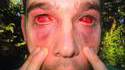 Accident de pressurisation