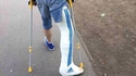Quand un russe a la jambe cassée