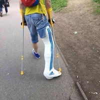 Quand un russe a la jambe cassée