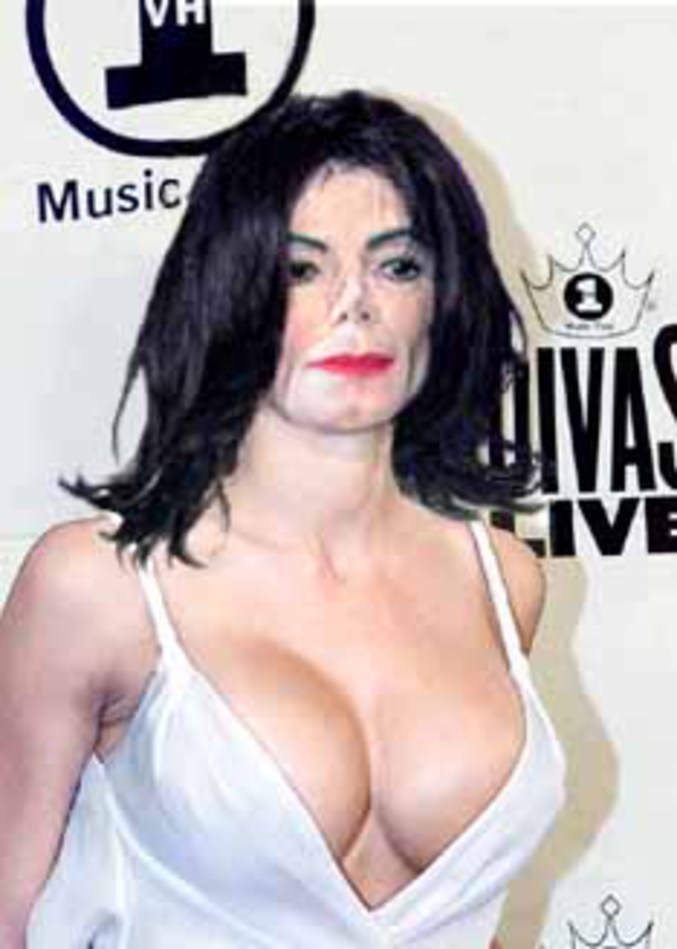 Une étrange maladie a fait pousser des seins à Michael Jackson.