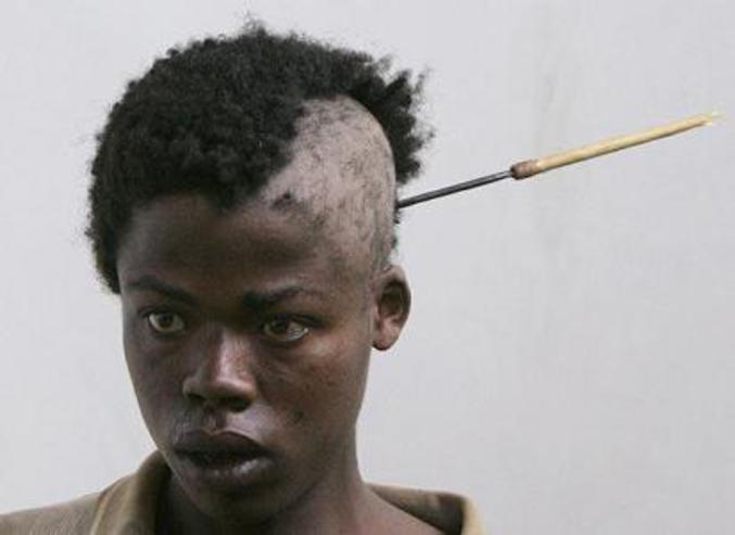 Un jeune garçon ayant reçu une flèche dans la tête attend à l'hôpital de Nakuru, Kenya.