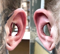 Pour en arriver là, il faut aussi des trous dans le cerveau !
