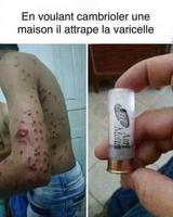 lanceur de varicelle vendu séparément