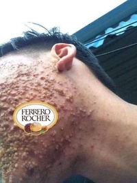 C'est les fêtes, pensez-y quand on vous offrira des Ferrero 