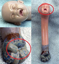 Un coup de poing et le bébé pleure