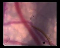 Un moustique trouve un vaisseau sanguin