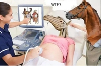 La première échographie