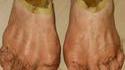 Chaussons de Hobbit