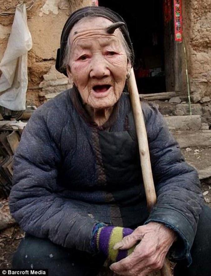 Une femme chinoise qui se voit pousser une corne sur son front (une deuxieme est en train de naître).