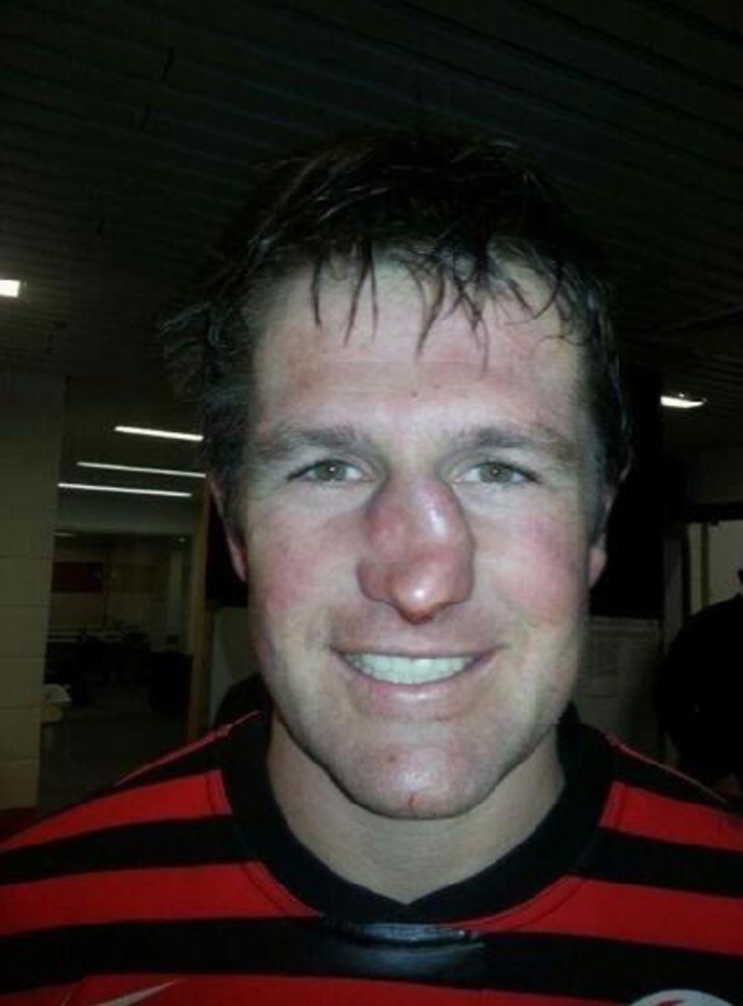 Le nez du rugbyman sud-africain Ernst Joubert (Saracens, Londres) est assez incroyable.