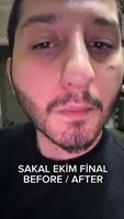 La barbe a la fin 