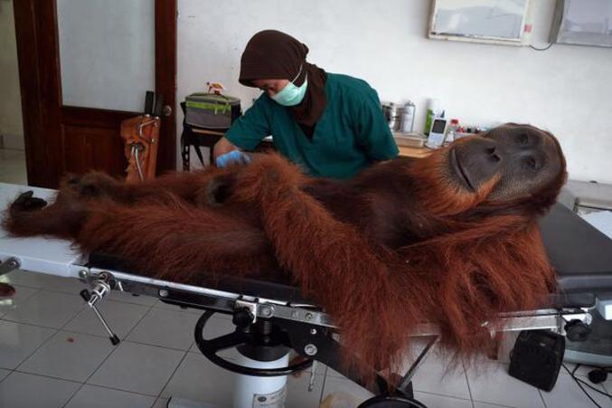 Une vétérinaire retire des plombs de carabine à air comprimé d'un Orang-Outan mâle de 14 ans. (Sumatran Orangutan Conservation Programme / Indonésie)