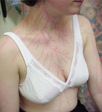 Elle a eu le coup de foudre