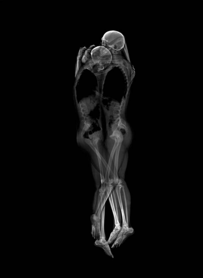 Un extrait d'une série de couples enlacés passés au rayons-X, réalisée par les photographes japonaises Ayako Kanda et Mayuka Hayashi.