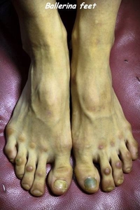 Des pieds de ballerine