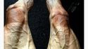 Jambes d'un coureur du Tour de France