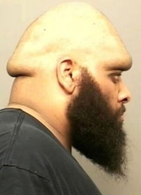 Tête de bite
