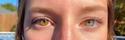 Des yeux vairons