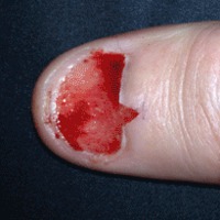 Quand un ongle repousse