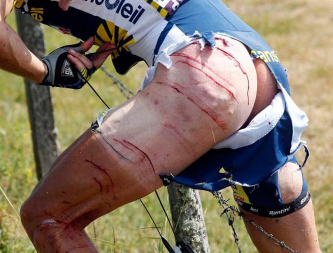 La chute du coureur Johnny Hoogerland suite à un accident avec une voiture de France Télévisions sur le Tour de France lui a valu une trentaine de points de suture.
