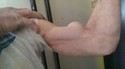Petit muscle