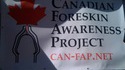 Can fap