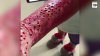 Êtes-vous trypophobe ?