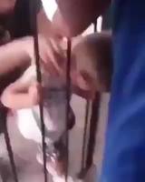 Quand la tête ne passe pas