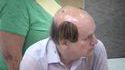 Petits rajouts capillaires pour chauve