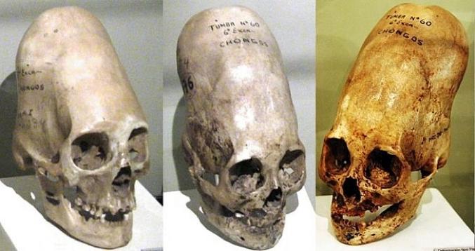 C’est les premières traces du néandertal  que nous avons de déformation crânienne , ils ont été trouvés en Irak; c’était une coutume de l’âge de bronze  très répandue en Asie, en Afrique et en Amérique . 
