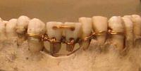 De l'usage du fil dentaire en Egypte ancienne.