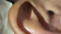 Comment bien se laver les oreilles