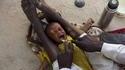 ORL africain