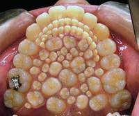 Des dents