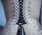 Corset 
