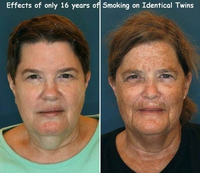 Fumer fait la peau moche